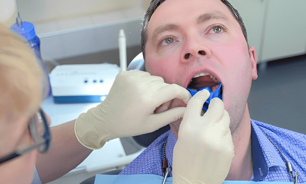 Bruxism Night Guard Edmonton