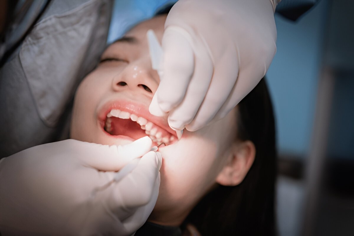 Tooth Extractions Edmonton