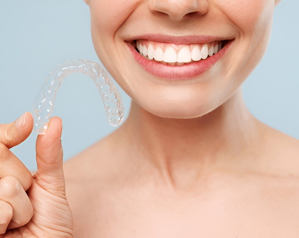 Clear Braces Edmonton